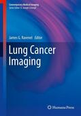 Ravenel |  Lung Cancer Imaging | eBook | Sack Fachmedien