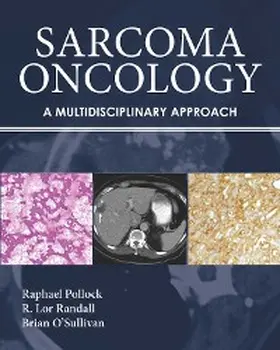 Pollock / Randall / O'Sullivan |  Sarcoma Oncology | eBook | Sack Fachmedien