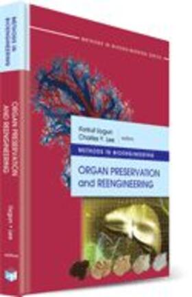 Uygun / Lee | Methods in Bioengineering: Organ Preservation and Reengineering | Buch | 978-1-60807-013-8 | sack.de
