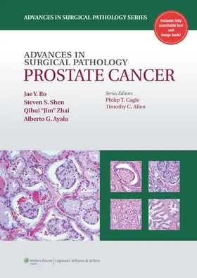 Ro / Shen / Zhai |  Advances in Surgical Pathology: Prostate Cancer | Buch |  Sack Fachmedien