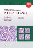 Ro / Shen / Zhai |  Advances in Surgical Pathology: Prostate Cancer | Buch |  Sack Fachmedien