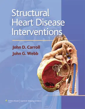 Carroll / Webb |  Structural Heart Disease Interventions | Buch |  Sack Fachmedien