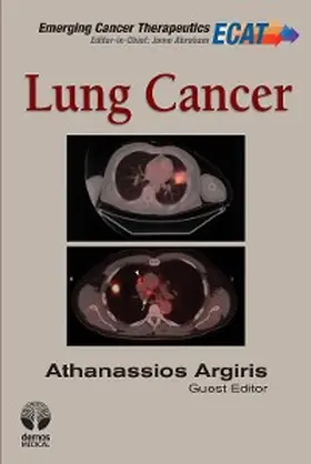 Argiris |  Lung Cancer | eBook | Sack Fachmedien