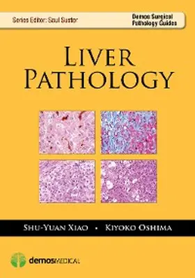 Oshima / Xiao |  Liver Pathology | eBook | Sack Fachmedien