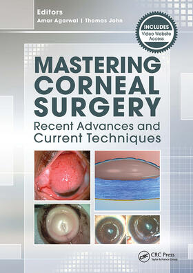 Agarwal | Mastering Corneal Surgery | Buch | 978-1-61711-640-7 | sack.de