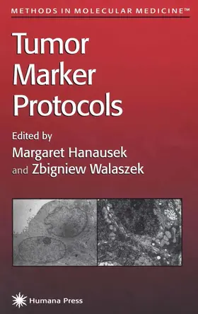 Hanausek / Walaszek |  Tumor Marker Protocols | Buch |  Sack Fachmedien