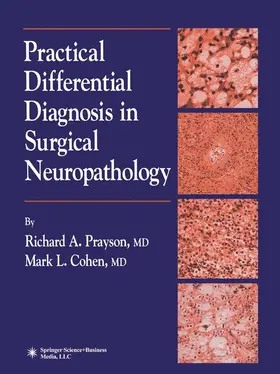 Prayson / Cohen |  Practical Differential Diagnosis in Surgical Neuropathology | Buch |  Sack Fachmedien