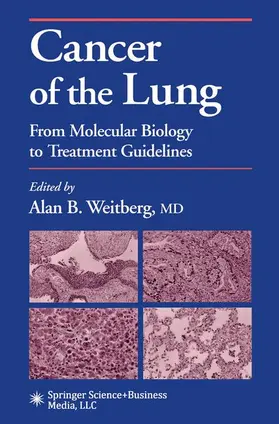 Weitberg |  Cancer of the Lung | Buch |  Sack Fachmedien