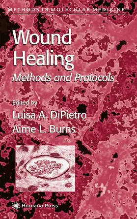 DiPietro / Burns | Wound Healing | Buch | 978-1-61737-296-4 | www.sack.de