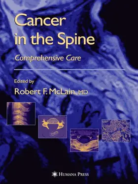 McLain / Markman / Benzel | Cancer in the Spine | Buch | 978-1-61737-340-4 | www.sack.de