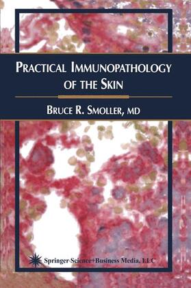 Smoller | Practical Immunopathology of the Skin | Buch | 978-1-61737-389-3 | sack.de