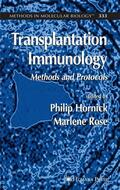 Hornick |  Transplantation Immunology | Buch |  Sack Fachmedien