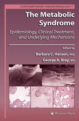 Hansen / Bray |  The Metabolic Syndrome: | Buch |  Sack Fachmedien
