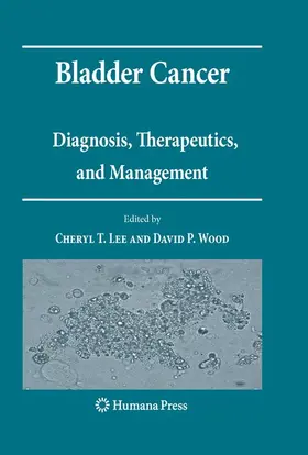 Wood / Lee |  Bladder Cancer | Buch |  Sack Fachmedien