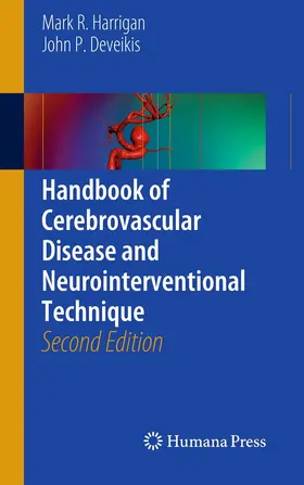 Harrigan / Deveikis | Handbook of Cerebrovascular Disease and Neurointerventional Technique | E-Book | sack.de