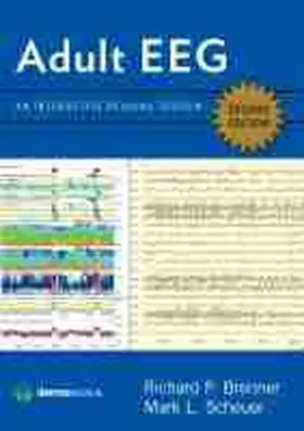 Brenner / Scheuer |  Adult Eeg, Second Edition: An Interactive Reading Session | Buch |  Sack Fachmedien