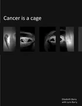 Barry |  Cancer Is A Cage | eBook | Sack Fachmedien