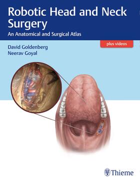 Goldenberg / Goyal | Robotic Head and Neck Surgery | Buch | 978-1-62623-003-3 | sack.de