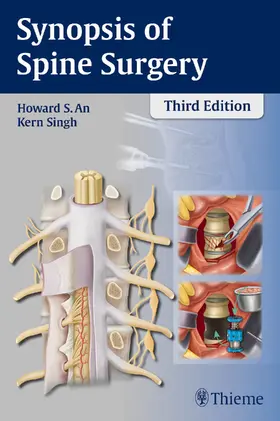 An / Singh | Synopsis of Spine Surgery | Buch | 978-1-62623-030-9 | www.sack.de