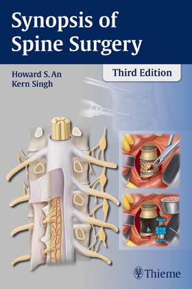 An / Singh | Synopsis of Spine Surgery | Buch | 978-1-62623-030-9 | sack.de