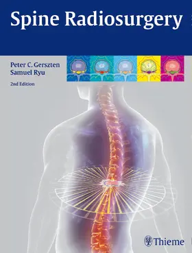 Gerszten / Ryu | Spine Radiosurgery | E-Book | www.sack.de