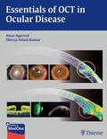 Agarwal / Kumar |  Essentials of Oct in Ocular Disease | Buch |  Sack Fachmedien