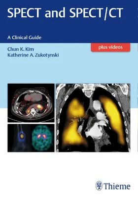 Kim / Zukotynski | Spect and Spect/CT | Buch | 978-1-62623-151-1 | sack.de