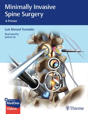 Tumialan | Minimally Invasive Spine Surgery | Medienkombination | 978-1-62623-218-1 | sack.de