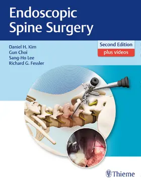 Kim / Choi / Lee | Endoscopic Spine Surgery | Buch | 978-1-62623-264-8 | sack.de