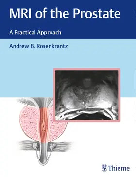 Rosenkrantz | MRI of the Prostate | E-Book | www.sack.de