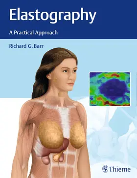 Barr | Elastography | Buch | 978-1-62623-271-6 | sack.de