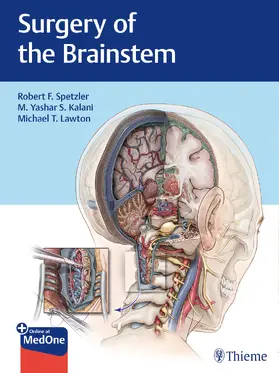 Spetzler / Kalani / Lawton | Surgery of the Brainstem | E-Book | sack.de