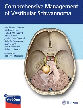 Carlson / Driscoll / Link | Comprehensive Management of Vestibular Schwannoma | Buch | 978-1-62623-331-7 | sack.de
