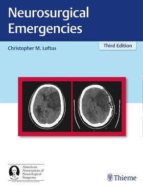Loftus | Neurosurgical Emergencies | Buch | 978-1-62623-333-1 | sack.de