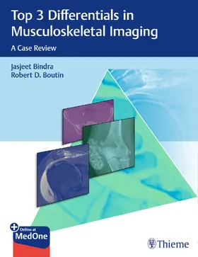 Bindra / Boutin |  Top 3 Differentials in Musculoskeletal Imaging | Buch |  Sack Fachmedien