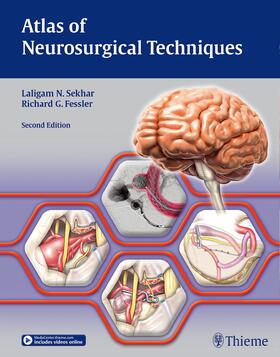 Fessler / Sekhar | Atlas of Neurosurgical Techniques. Brain | Buch | 978-1-62623-388-1 | sack.de