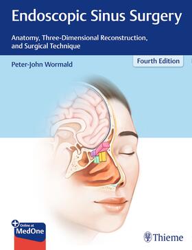 Wormald | Endoscopic Sinus Surgery | E-Book | sack.de