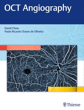 Chow / Chaves de Oliveira | OCT Angiography | Buch | 978-1-62623-473-4 | sack.de