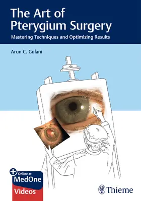 Gulani | The Art of Pterygium Surgery | Buch | 978-1-62623-511-3 | sack.de
