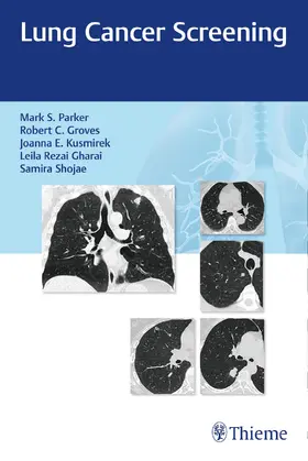 Parker / Groves / Kusmirek | Lung Cancer Screening | Buch | 978-1-62623-513-7 | www.sack.de
