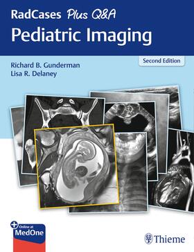 Gunderman / Delaney | RadCases Plus Q&A Pediatric Imaging | Buch | 978-1-62623-519-9 | sack.de