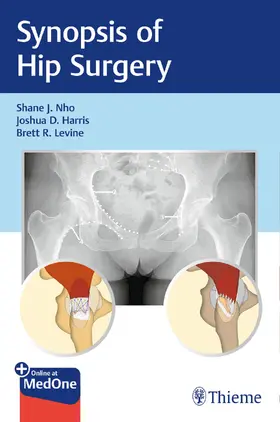 Nho / Harris / Levine | Synopsis of Hip Surgery | E-Book | www.sack.de