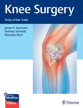 Stannard / Schmidt / Kfuri | Knee Surgery | Buch | 978-1-62623-541-0 | www.sack.de