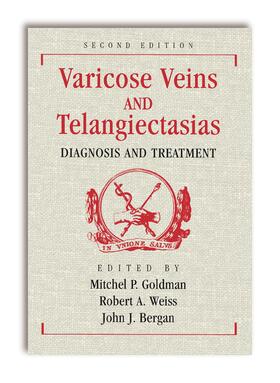 Goldman / Weiss / Bergan | Varicose Veins and Telangiectasias: Diagnosis and Treatment, Second Edition | Buch | 978-1-62623-548-9 | sack.de