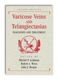 Goldman / Weiss / Bergan |  Varicose Veins and Telangiectasias: Diagnosis and Treatment, Second Edition | Buch |  Sack Fachmedien