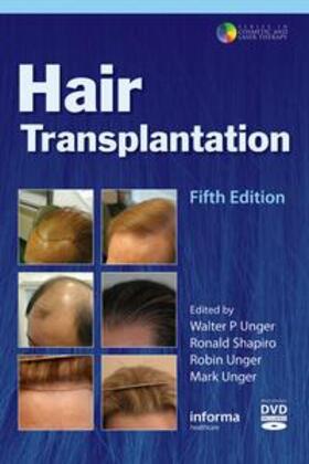 Unger / Shapiro | Hair Transplantation | Medienkombination | 978-1-62623-570-0 | sack.de