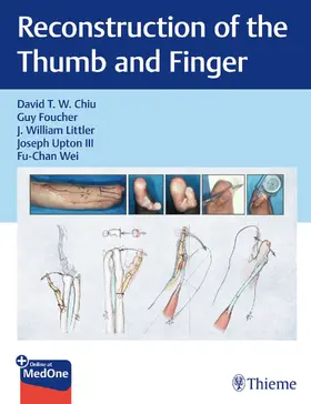 Chiu / Foucher / Littler |  Reconstruction of the Thumb and Finger | Buch |  Sack Fachmedien