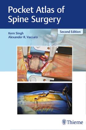 Singh / Vaccaro | Pocket Atlas of Spine Surgery | Buch | 978-1-62623-623-3 | sack.de