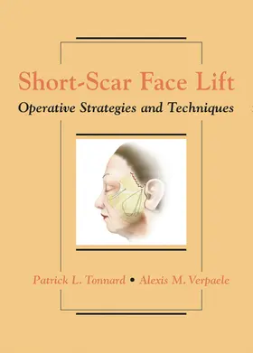 Tonnard / Verpaele |  Short-Scar Face Lift | Buch |  Sack Fachmedien