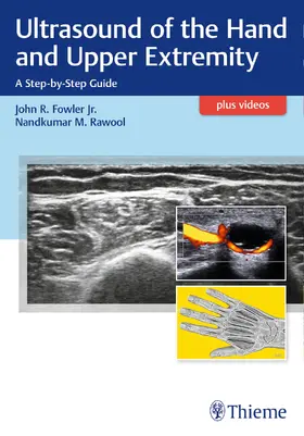 Fowler / Rawool |  Ultrasound of the Hand and Upper Extremity | Buch |  Sack Fachmedien